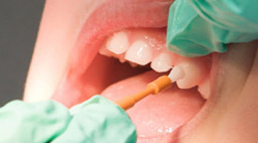 edşrne flor uygulaması