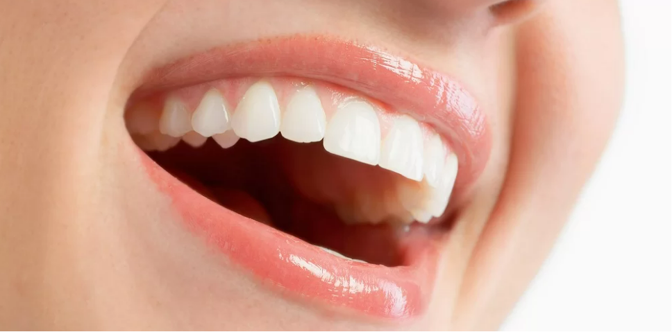 hollywood gülüşü edirne