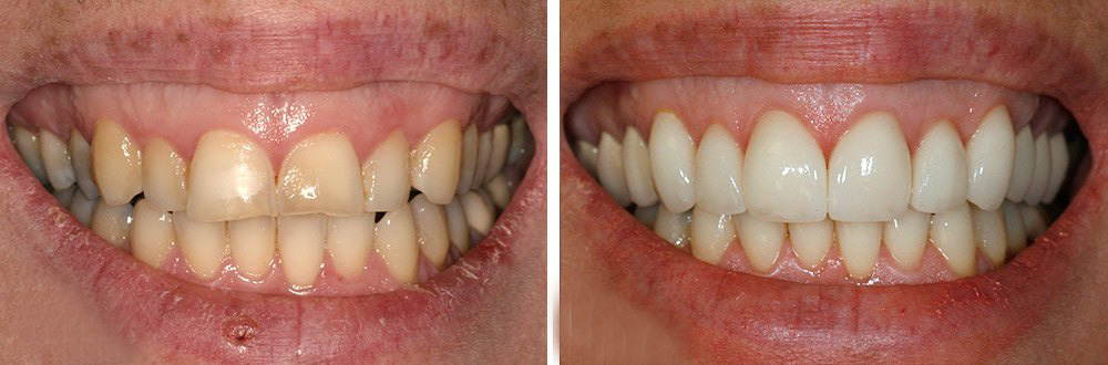 diş düzenleme tedavileri edirne