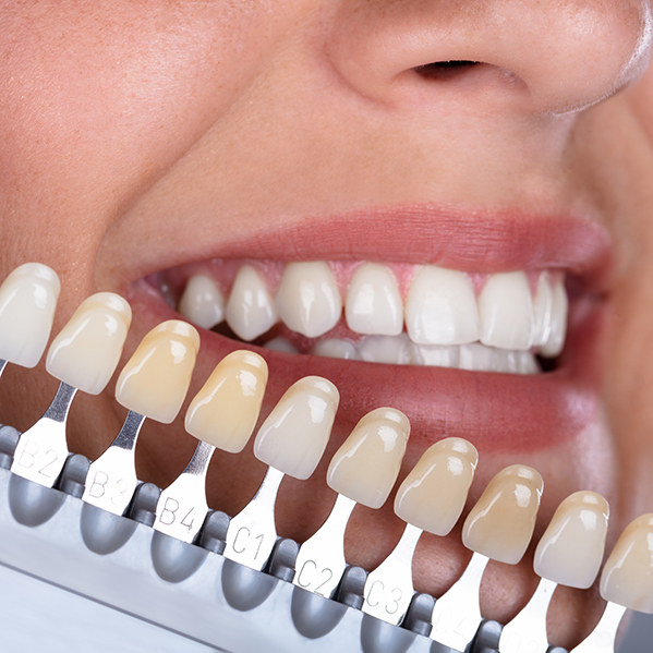 zirkoryum diş edirne